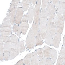 Integrin alpha 6/CD49f Antibody (CL6957), Novus Biologicals:Antibodies:Primary